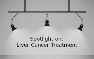 Spotlight on liver cancer treatment